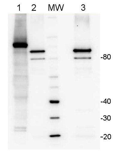 western blot using anti-LOX antibodies